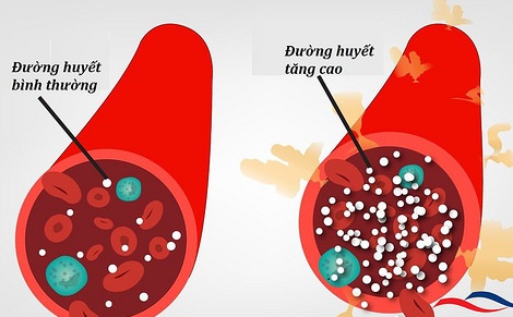 Khi đường huyết không ổn định - Hình 1
