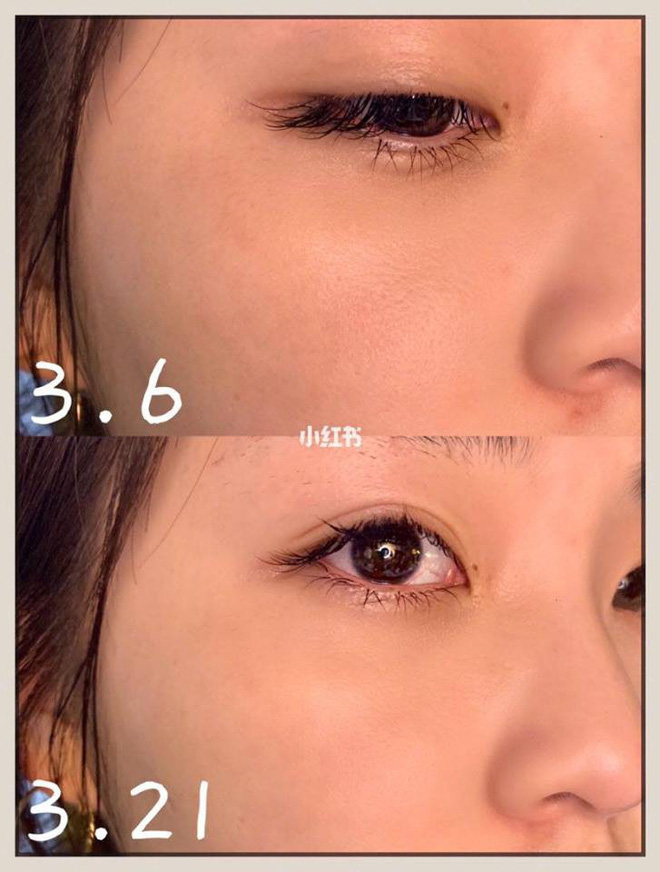 Để da mướt mát không lỗ chân lông, hội con gái Trung Quốc đang truyền tai bí kíp đắp khăn nóng vô cùng đơn giản - Hình 4