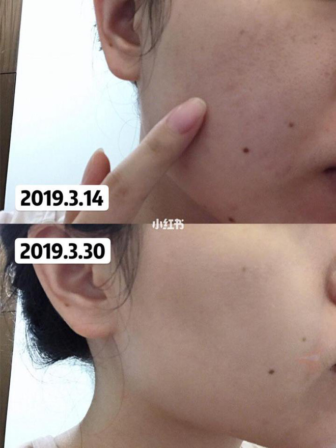 Để da mướt mát không lỗ chân lông, hội con gái Trung Quốc đang truyền tai bí kíp đắp khăn nóng vô cùng đơn giản - Hình 6