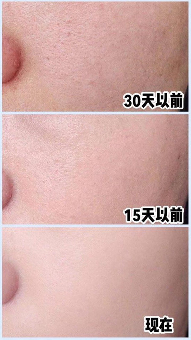 Để da mướt mát không lỗ chân lông, hội con gái Trung Quốc đang truyền tai bí kíp đắp khăn nóng vô cùng đơn giản - Hình 5