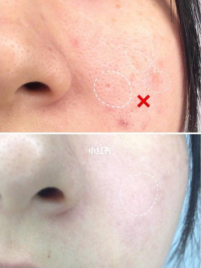 Để da mướt mát không lỗ chân lông, hội con gái Trung Quốc đang truyền tai bí kíp đắp khăn nóng vô cùng đơn giản - Hình 2