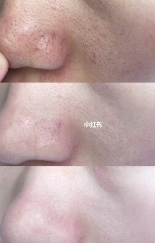 Để da mướt mát không lỗ chân lông, hội con gái Trung Quốc đang truyền tai bí kíp đắp khăn nóng vô cùng đơn giản - Hình 3