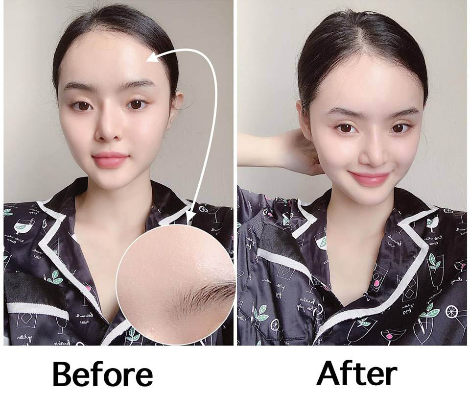 Em gái Angela Phương Trinh đẹp hơn xưa gấp bội, liệu có phải do thuốc tiên? - Hình 2