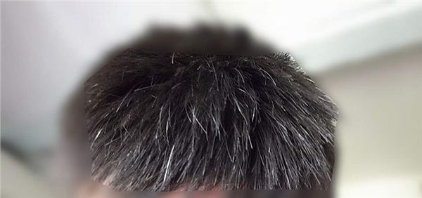 6 bước giải quyết vấn đề tóc bạc sớm ở nam giới