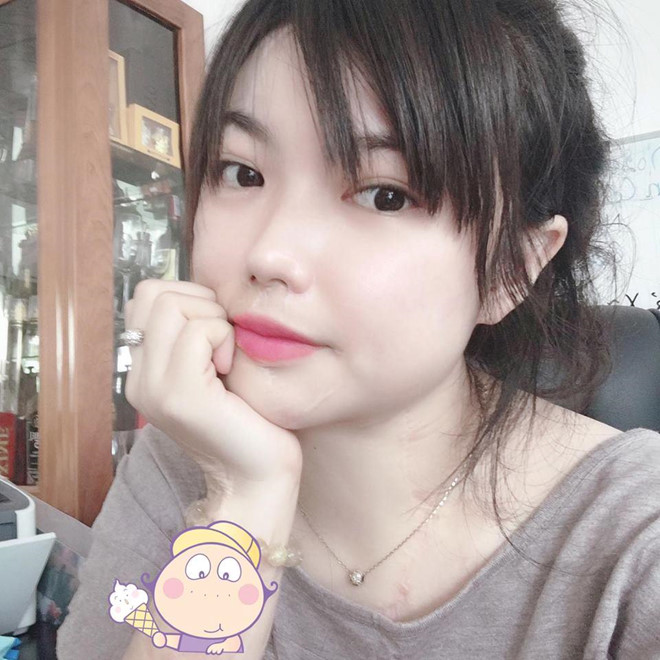 Cô gái xinh đẹp bị tạt axit và 20 lần phẫu thuật lấy lại diện mạo - Hình 3