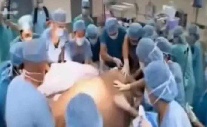 Người phụ nữ mang thai bụng to vượt mặt, đến ngày sinh bác sĩ bắt mổ run tay: 'Nguyên cả một đội bóng 11 người' - Hình 2
