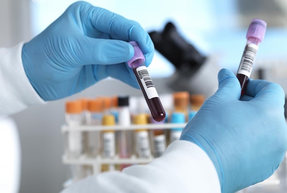 Nồng độ cholesterol thấp có thể gây ra nhiều vấn đề sức khỏe - Hình 2