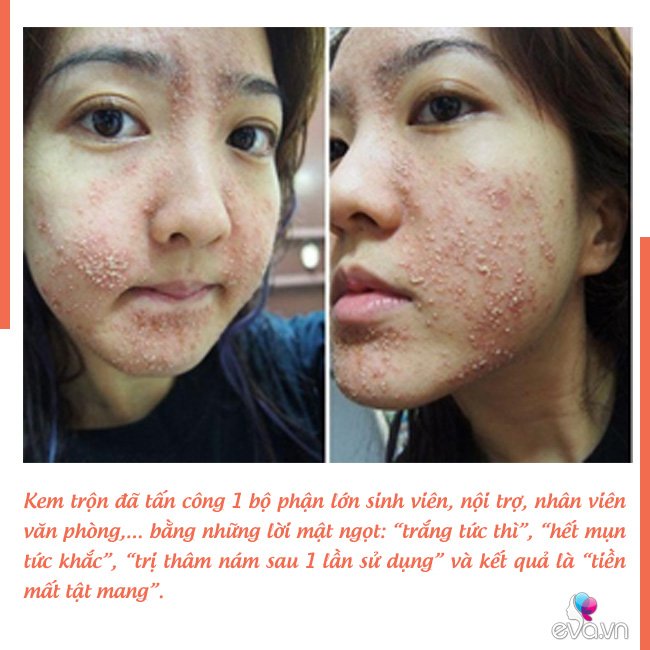 Đừng chi tiền vội, đây là 5 cách giúp chị em phân biệt thủ đoạn kem trộn tinh vi - Hình 1