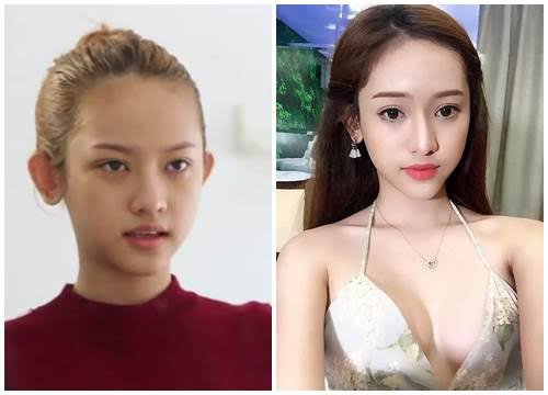 Thúy Vi lộ mặt cứng đơ, kém mịn màng khác xa ảnh tự sướng ảo tung chảo - Hình 9