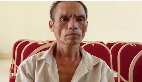 Bé trai bị chú họ dùng dao chém đứt lìa bàn tay: Mắt trái đã bị hỏng hoàn toàn - Hình 2
