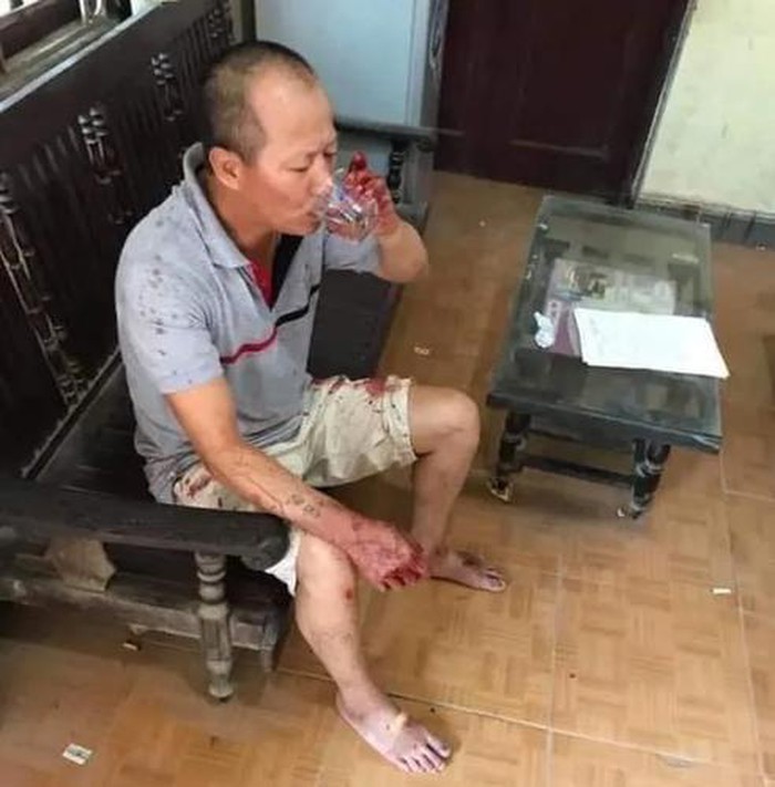 Những án mạng đau lòng do anh em tranh chấp đất đai - Hình 4