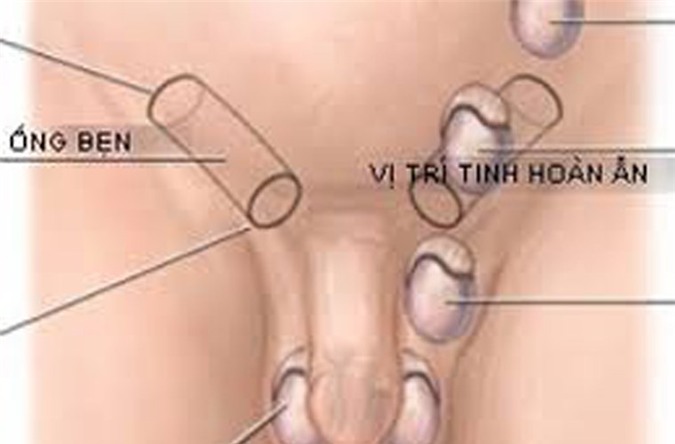 Cách ngừa ung thư tinh hoàn hiệu quả nhất - Hình 1