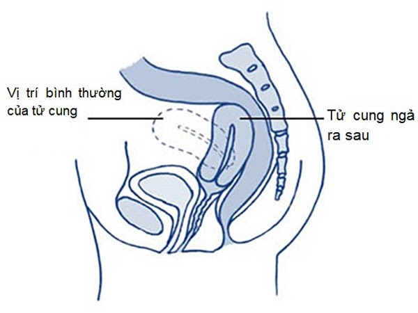 tai sao toi bi dau mong trong ki rot dau fbb5c9