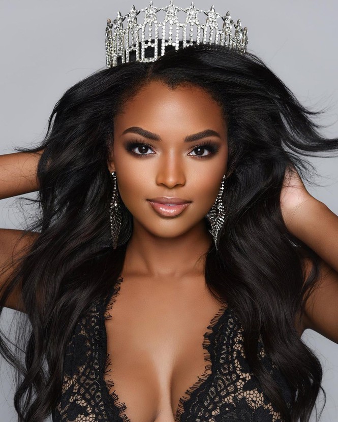 Sắc vóc nóng bỏng của cô gái gốc Phi 22 tuổi đăng quang Hoa hậu Mỹ 2020 - Hình 4