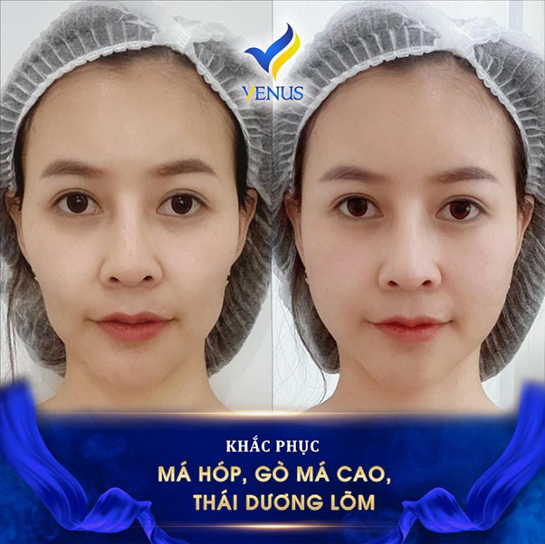 Khách hàng lặn lội từ Bắc Giang về Hà Nội để tìm lại 10 năm thanh xuân với Tái sinh đa tầng - Hình 3