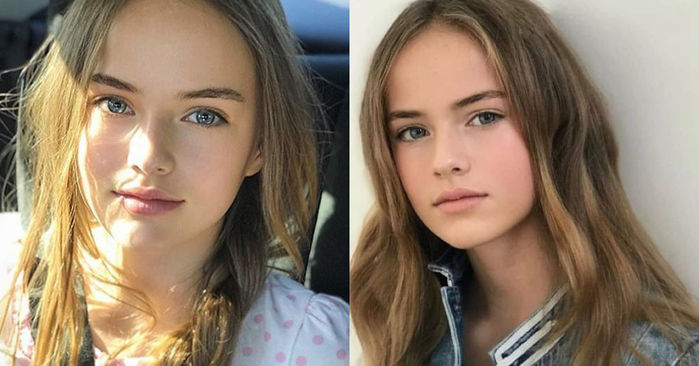 5 cô bé đẹp nhất thế giới ngày ấy: Cô bé mắt xanh ngày càng trổ sắc - Hình 10