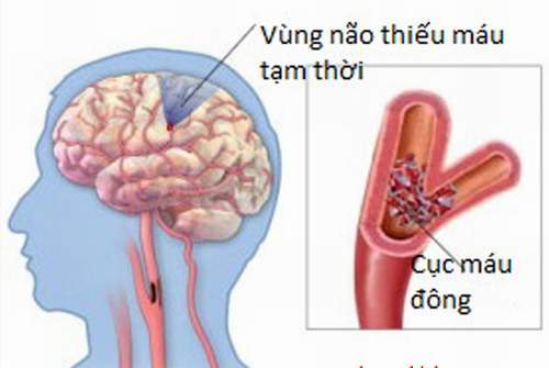 cho xem thuong thieu mau nao cuc bo tam thoi 120 5347412