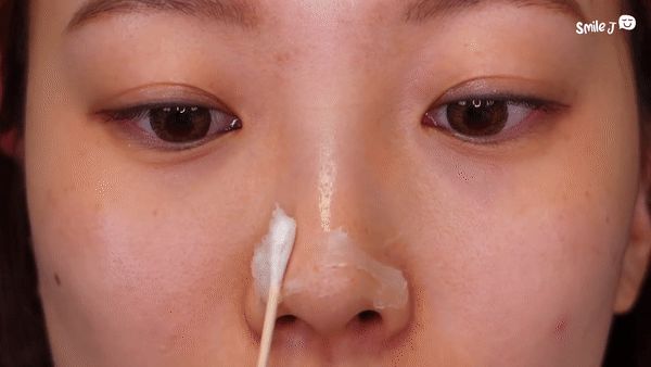 Xử lý mụn đầu đen hiệu quả bằng vaseline và dầu tẩy trang - Hình 2