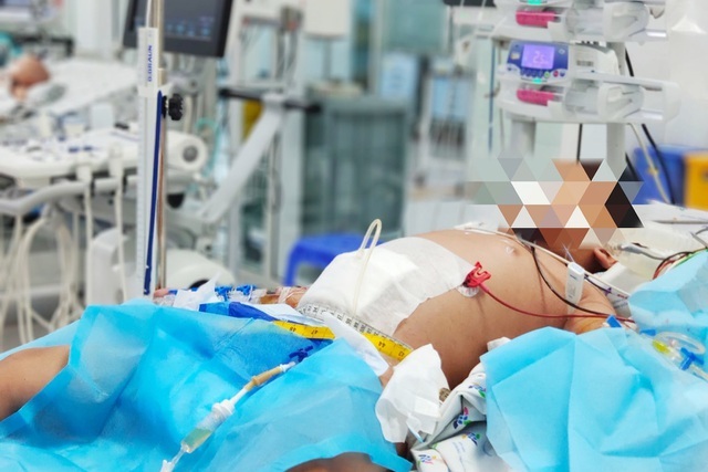 Bé 9 tuổi bị sốc sốt xuất huyết nặng khiến máu cô đặc, suy đa tạng - Hình 1