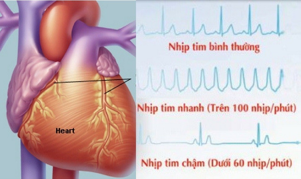 rui ro tiem an khi dung thuoc chong roi loan nhip tim 899 5459365