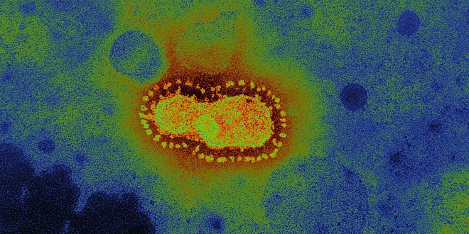 Hình ảnh về chủng virus corona mới - Hình 2