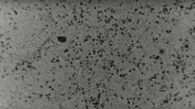 Hình ảnh về chủng virus corona mới - Hình 1