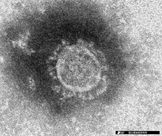 Hình ảnh về chủng virus corona mới - Hình 5
