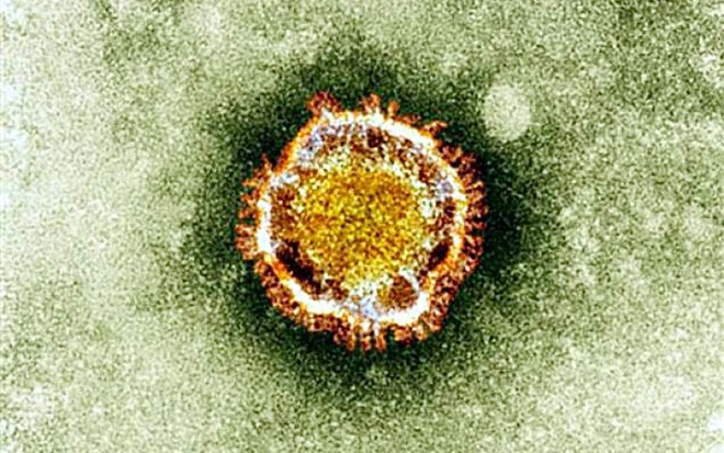 Hình ảnh về chủng virus corona mới - Hình 3