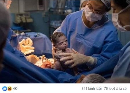Hình ảnh em bé vừa chào đời đã lườm xắt xéo bác sĩ khiến cư dân mạng được một trận cười thả ga - Hình 1