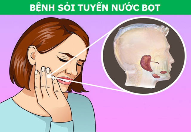 nhung con dau ky la xuat phat tu rang mieng noi len dieu gi ve suc khoe e65406