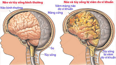 trieu chung quai bi o tre em de nhan biet nhat f65 4766913