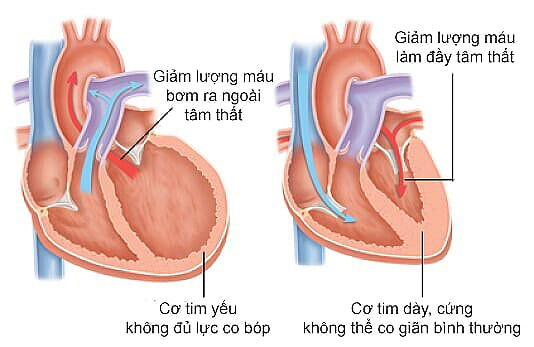 ho dau nguc kho tho khi gang suc trieu chung cua benh gi 684 4865697