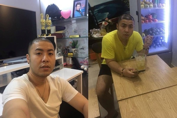 Lê Dương Bảo Lâm: Mũi tôi sửa 2 lần, mặt tiêm botox và gọt hàm - Hình 4