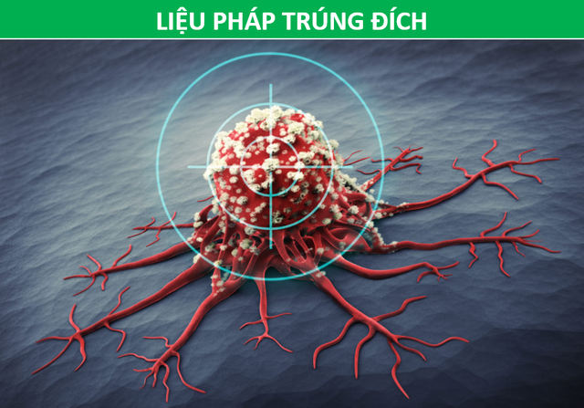 cac phuong phap dieu tri ung thu khac nhau nhu the nao cc0 4945587