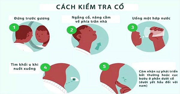 tu kiem tra benh tuyen giap nho 1 coc nuoc lam ngay keo nho ung thu de lau kho chua fb9 4950223