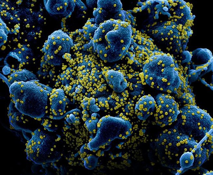 Sản xuất thành công kháng thể diệt virus corona - Hình 2