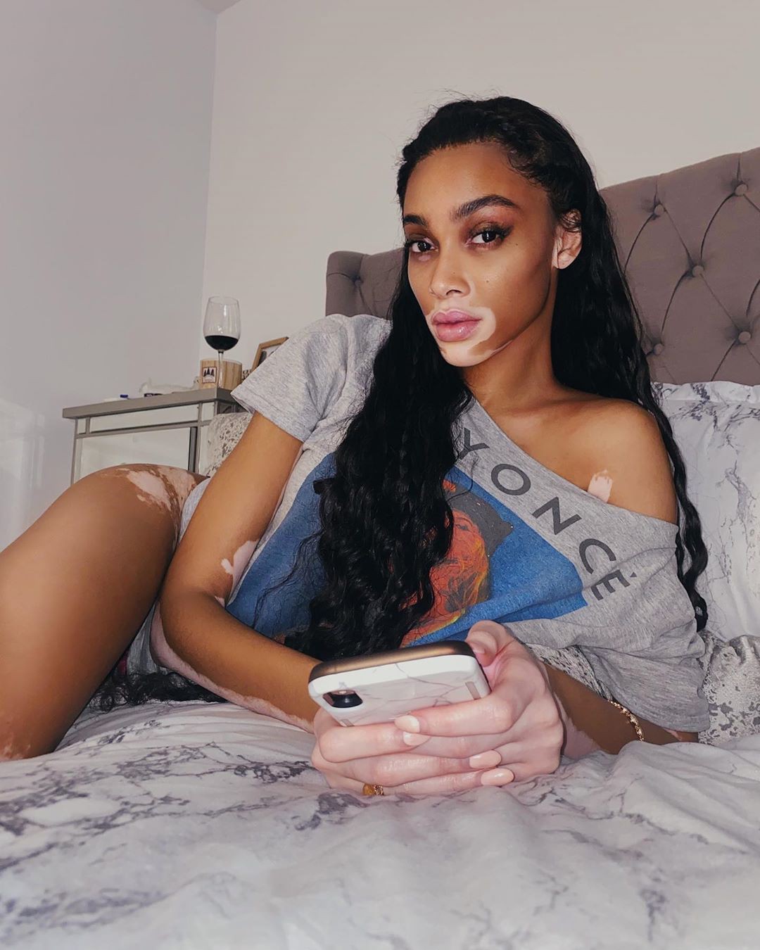 Winnie Harlow diện bikin.i thả dáng quyến rũ bên bể bơi - Hình 5