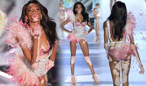 Winnie Harlow diện bikin.i thả dáng quyến rũ bên bể bơi - Hình 6
