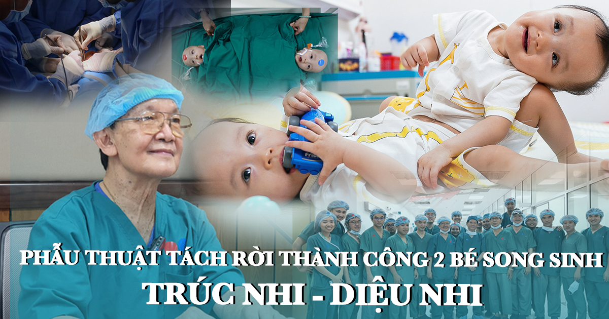 Phẫu thuật tách rời thành công 2 bé song sinh, kỳ tích làm từ trái tim. - Hình 2
