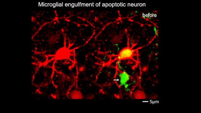 Bộ não loại bỏ tế bào thần kinh chết như thế nào? - Hình 2
