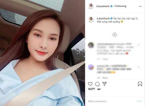 Bị nghi tiêm filler do mặt sưng vù, Bảo Thanh tiết lộ lý do khiến dân tình bật ngửa - Hình 6