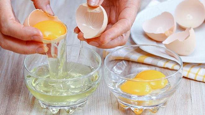 Rạn da tuổi dậy thì: Rắc rối ngoại hình khó nói thành lời của con gái - Hình 3