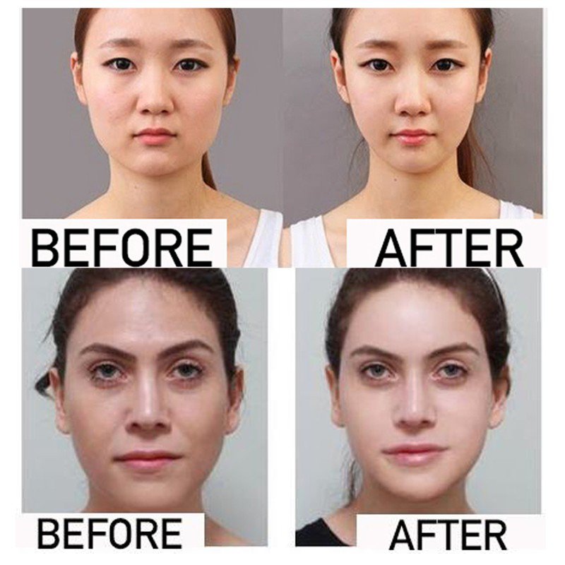 Hóa ra, Huyền My có chiếc cằm V-line thon gọn đều là nhờ món dụng cụ dễ mua - Hình 6