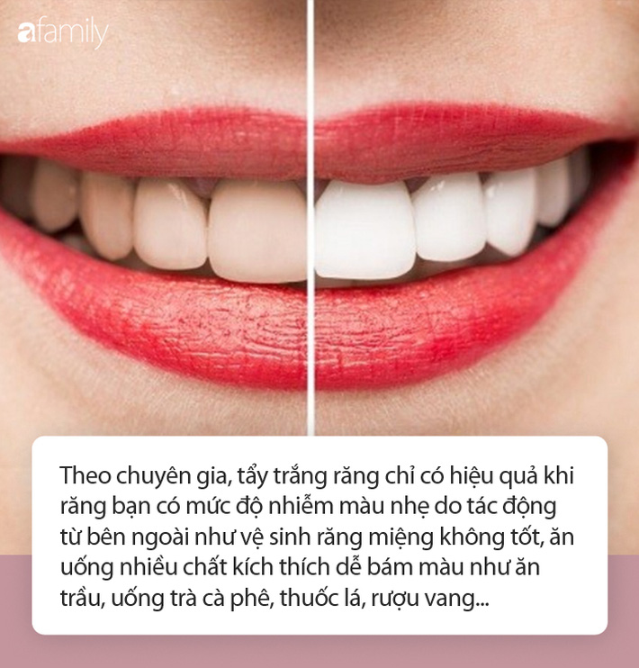 Bạn muốn sở hữu một hàm răng trắng sáng như ngọc trai nhưng không biết phải bắt đầu từ đâu? Hãy xem qua các sản phẩm giúp làm trắng răng tại nhà để có một nụ cười tươi rói và rạng rỡ hơn. Tận dụng ngay cơ hội để chăm sóc cho hàm răng của mình một cách tối ưu.