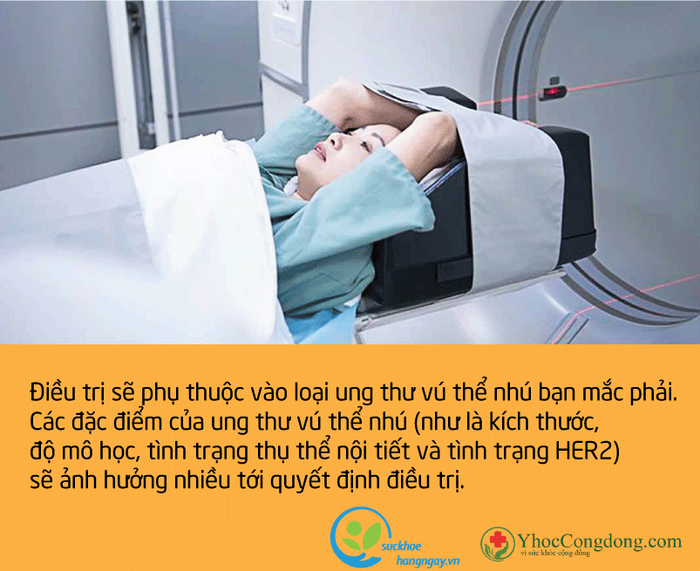 tat tan tat nhung dieu ban can biet ve ung thu vu the nhu 287 5263612