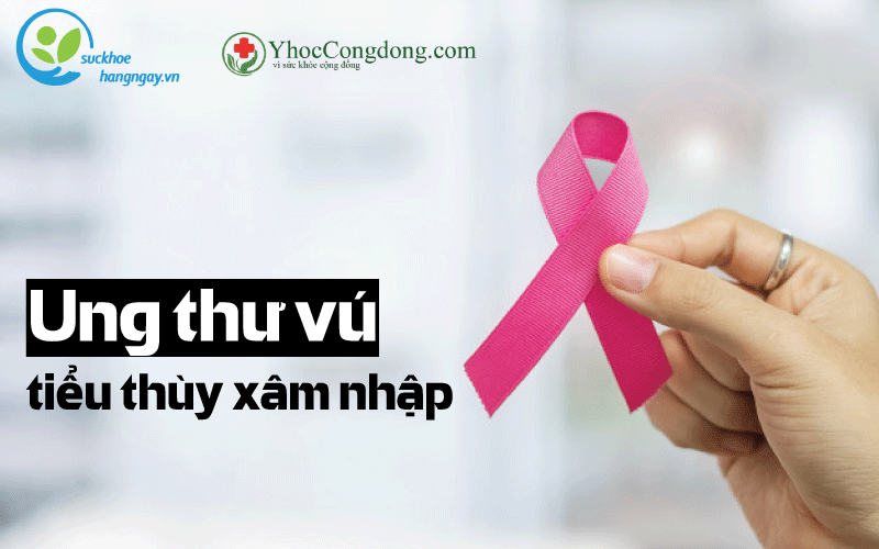 ung thu vu tieu thuy xam nhap nguyen nhan trieu chung chan doan va phuong phap dieu tri 474 5264084