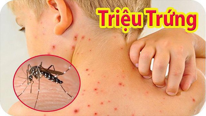 Cảnh báo sốt xuất huyết gia tăng ở trẻ nhỏ - Hình 1