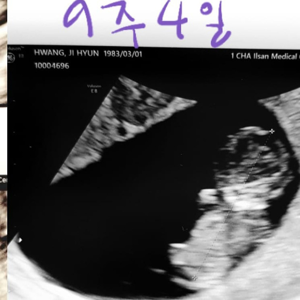 Điểm danh 'tập thể người yêu cũ' của Hyun Bin trước khi hẹn hò Son Ye Jin, tưởng không liên quan ai dè có điểm chung khó ngờ - Hình 4