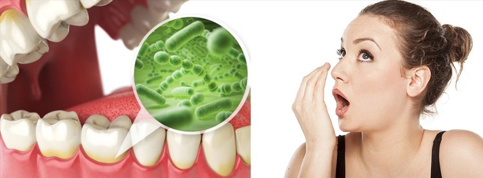 Tự pha nước súc miệng như thế nào cho chuẩn? - Hình 1