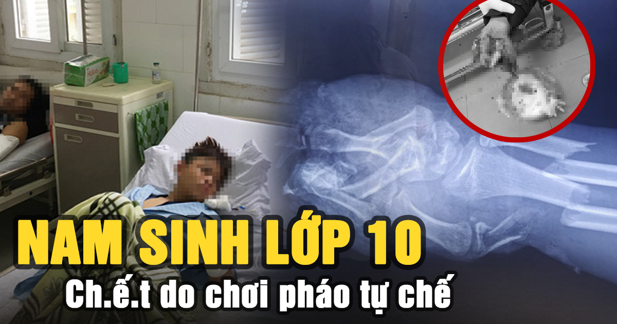 Nam sinh lớp 10 chết sau tiếng nổ lớn và hàng loạt học sinh thương vong do pháo tự chế - Hình 4